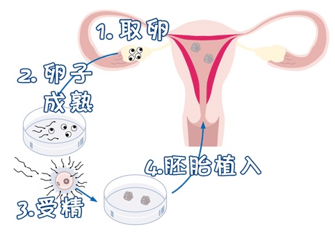 液氮存储